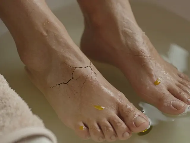 Co si dát na prasklo patu? Nejúčinnější řešení pro trhliny a sucho