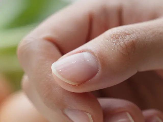 Jak poznat, že máte málo vitaminů - příznaky, které neignorujte